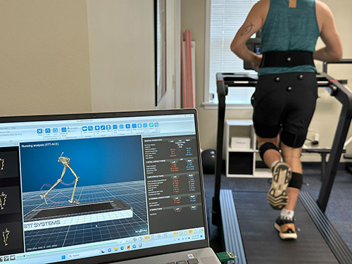Patient running on treadmill with computer maping movements